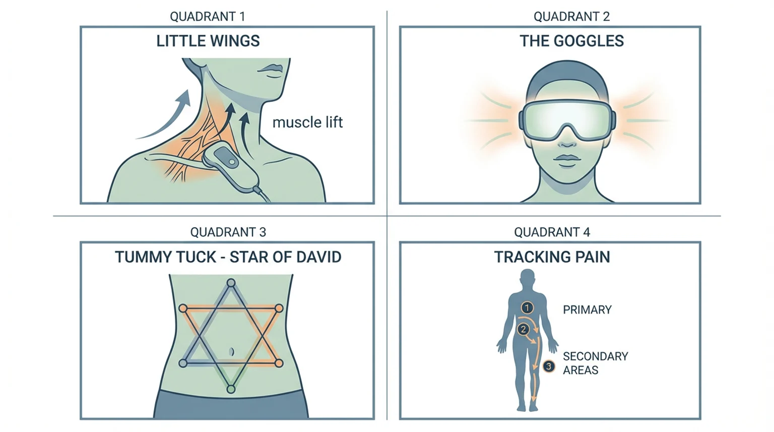 Medical infographic showing four quadrants: neck muscle lift, goggles, tummy tuck Star of David, and pain tracking.